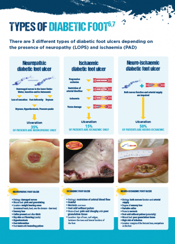 types of diabetic foot
